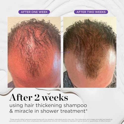 Dr. Groot Hair Thickening Shampoo, Korean Hair Care with Biotin, Rosemary Oil to Help Volumize