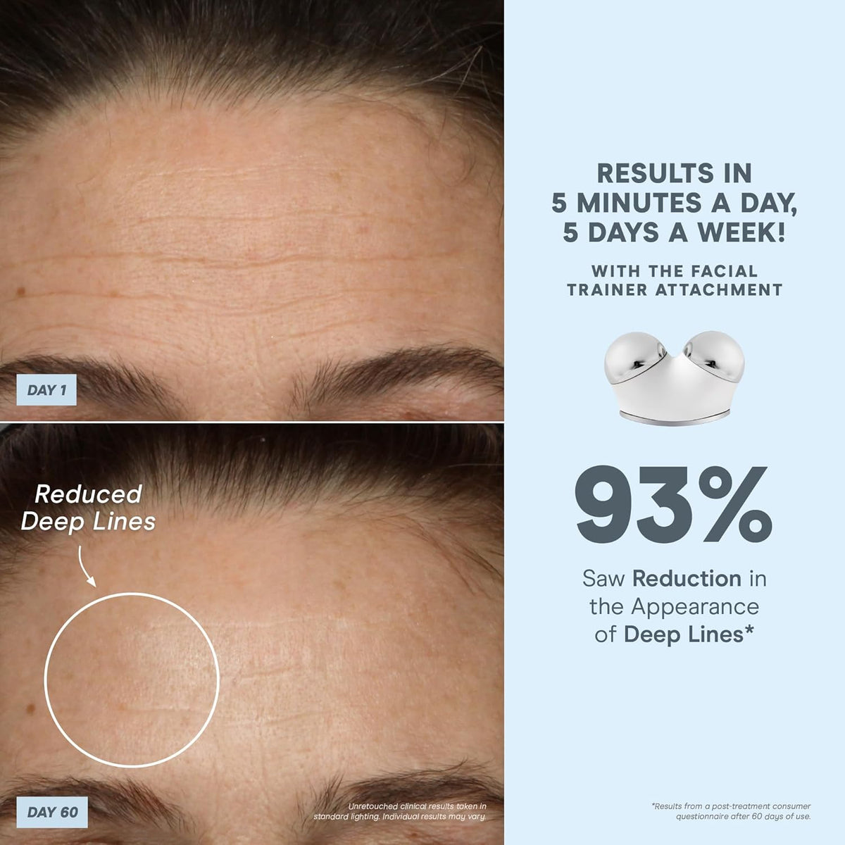 NuFACE TRINITY+ Microcurrent Facial Device Kit - FDA Cleared Face Sculpting & Neck Tightening