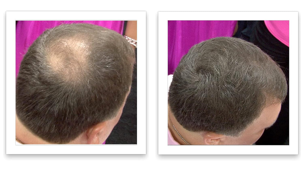 Caboki All-Natural Hair Building Fiber. Make Thin Hair Look 10X Fuller Instantly. Eliminate the