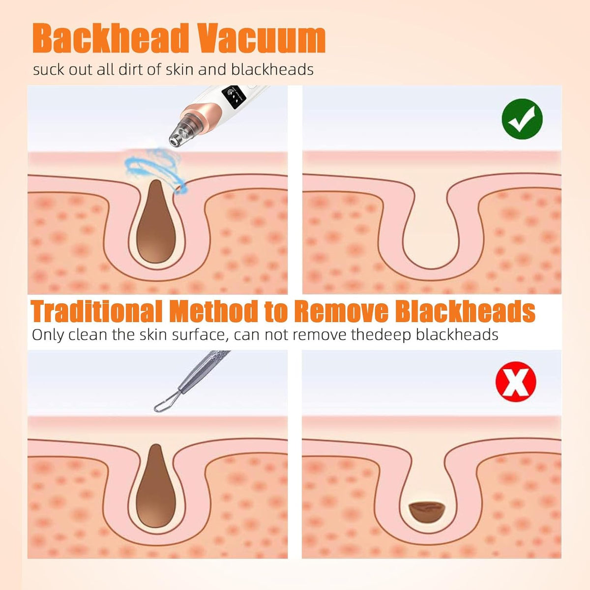 2025 Pore Vacuum, USB Rechargeable Blackhead Remover Vacuum,3 Levels Adjustable Pore Vacuum