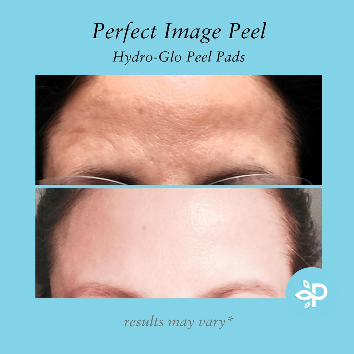 Hydro-Glo Peel Pads - Enhanced with Kojic, Mandelic, Glutathione, Licorice, Papaya, Pineapple