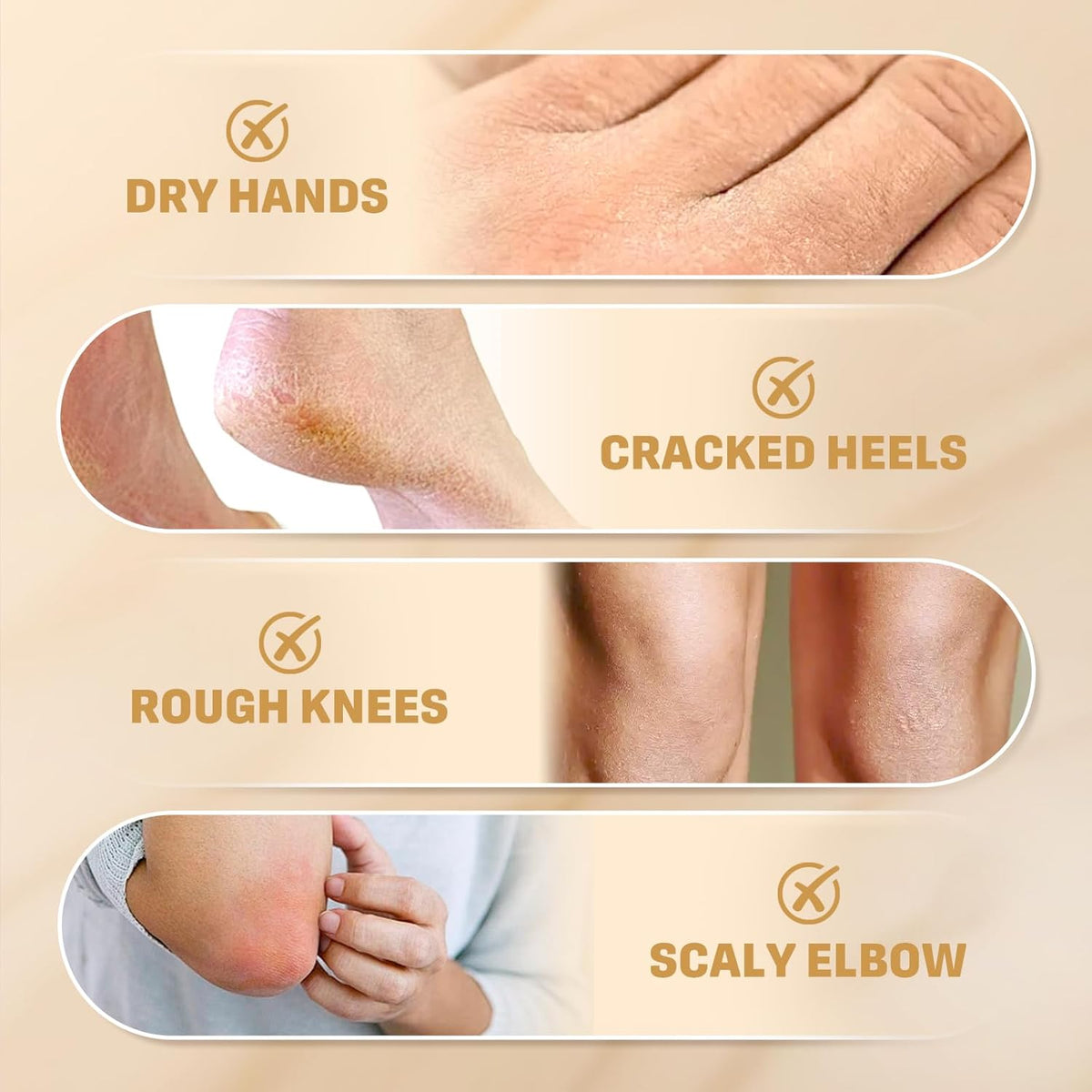60% Urea Cream with 2% Salicylic Acid, Urea Cream 60 Percent for Feet & Hands- Maximum Strength