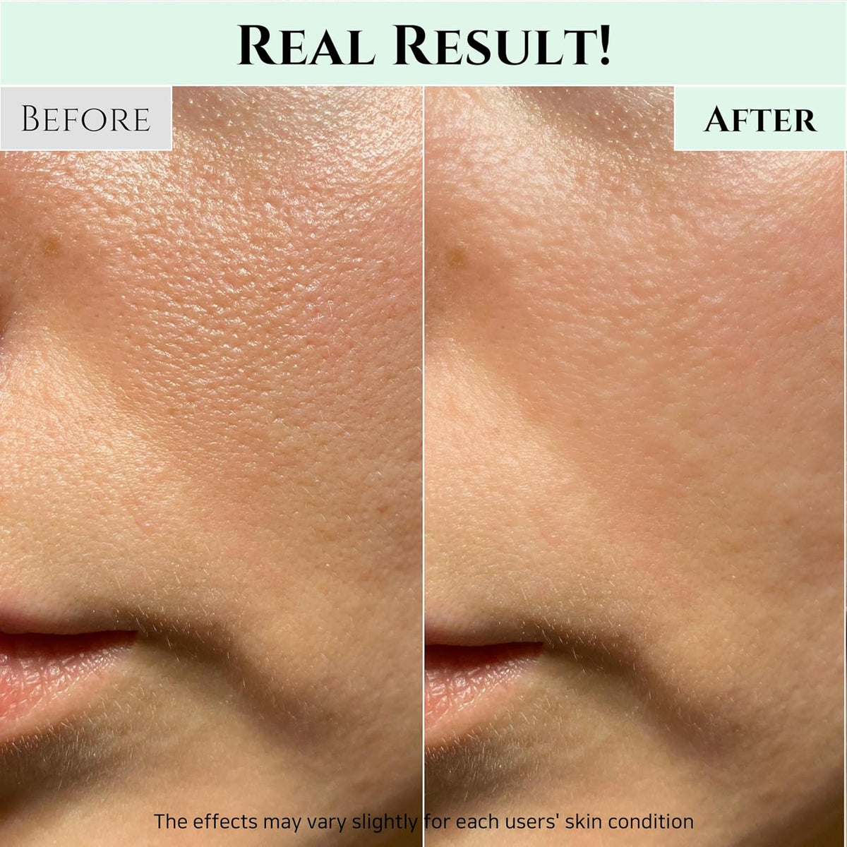Beauty of Joseon Green Plum Refreshing Cleanser Gel Type Deep Pore Cleansing, Acne Face Wash