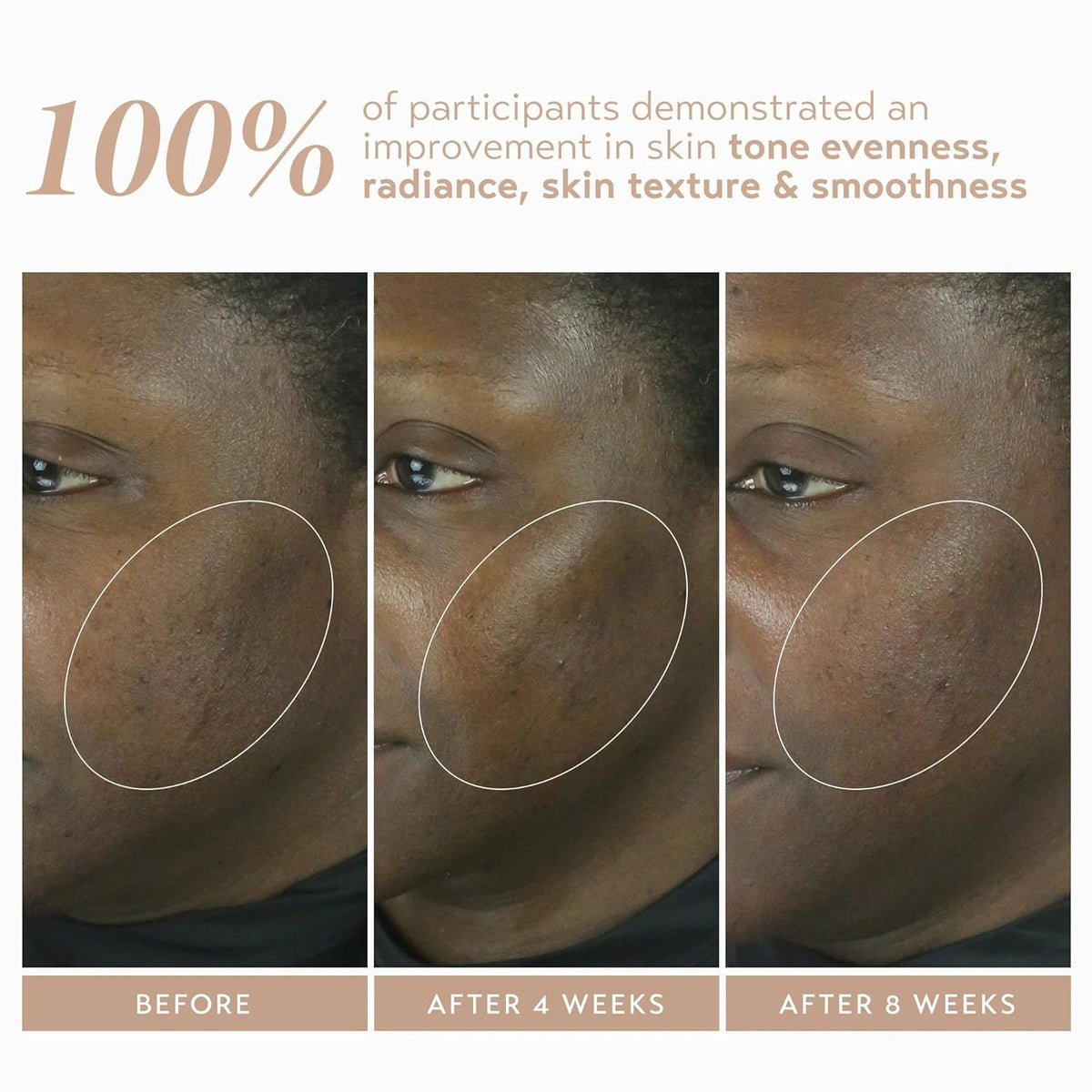 SHANI DARDEN SKIN CARE Retinol Reform with 1% Encapsulated Retinol Serum for Face & Neck, Gentle