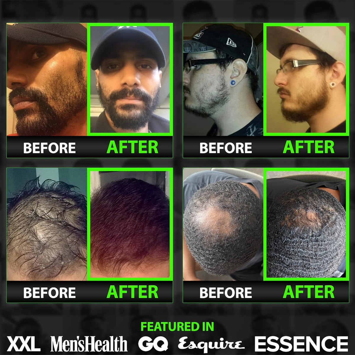 Beard Growth Kit w/ 2X Thickening Biotin Beard Balm for Men & Mustache Wax + GROW Maximum Strength