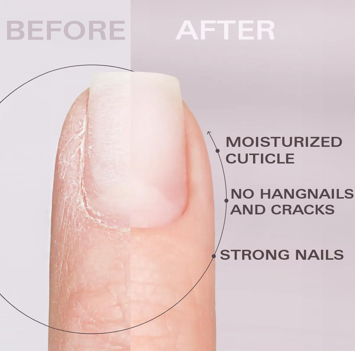 Nail Oil Cuticle Pen - Watermelon - Nail Strengthener & Growth Serum with Vitamin A, D, E, B5