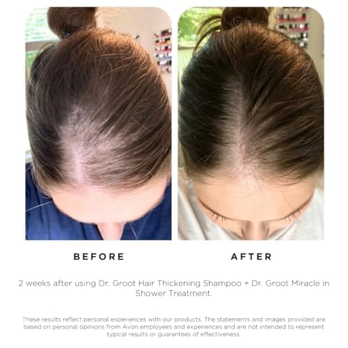 Dr. Groot Hair Thickening Shampoo, Korean Hair Care with Biotin, Rosemary Oil to Help Volumize