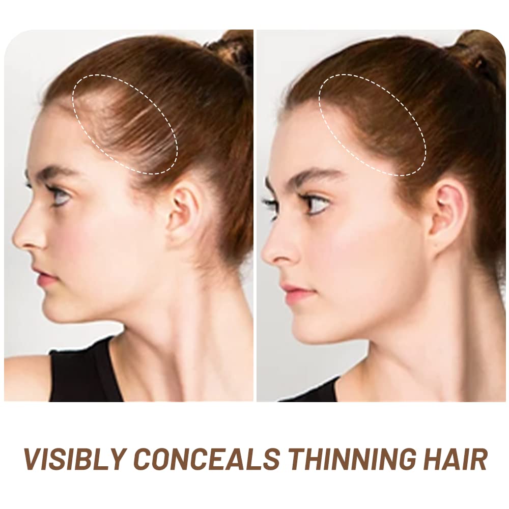 Root Touch Up Hair Powder, Instantly Gray Hair Root Cover Up Hairline Powder, Hair Concealer For
