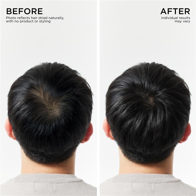 Dr. Groot Hair Thickening Shampoo, Korean Hair Care with Biotin, Rosemary Oil to Help Volumize