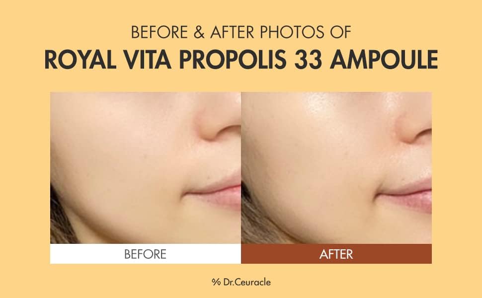 Dr.Ceuracle Royal Vita Propolis 33 Ampoule (30ml / 1.01 fl. oz.) - Ultimate Glow and Nourish