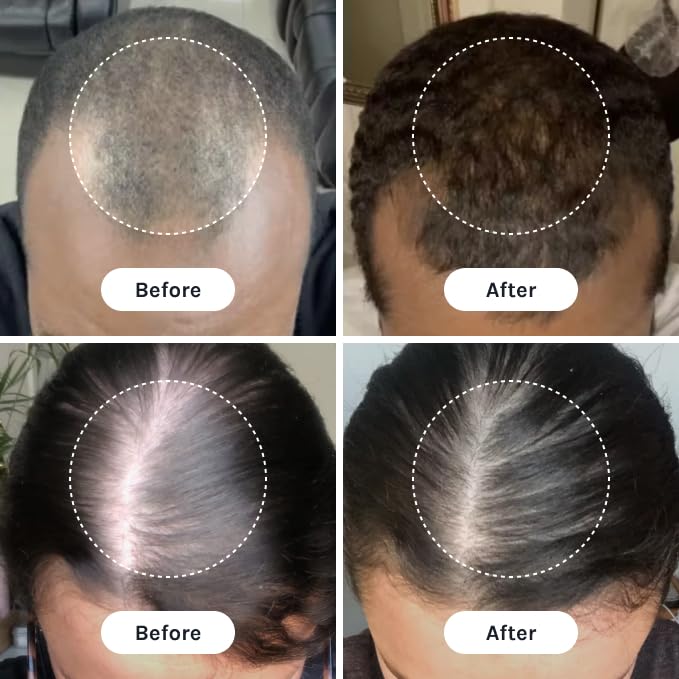 InfiniWell PTD-DBM Peptide Hair Serum for Fuller-Looking Hair - Scalp Treatment for Visible Growth