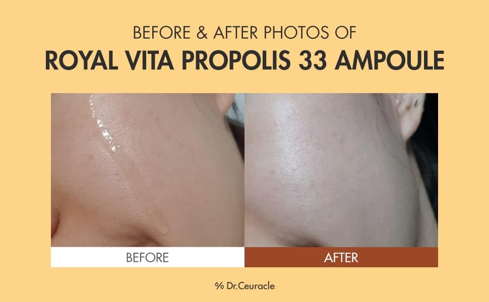 Dr.Ceuracle Royal Vita Propolis 33 Ampoule (30ml / 1.01 fl. oz.) - Ultimate Glow and Nourish