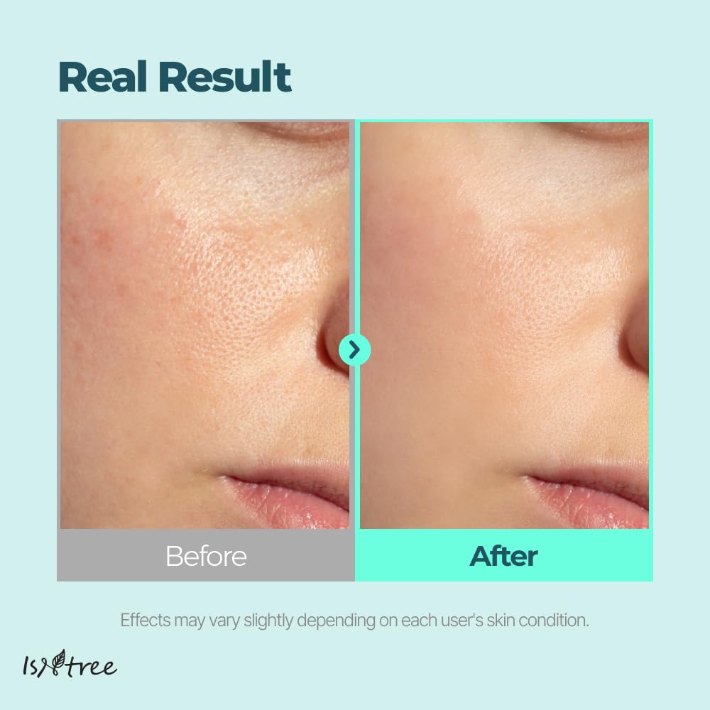 ISNTREE Gim PDRN Hydro Bouncy Ampoule 50ml, 1.69 fl oz | Korean SEAWEED Skincare Facial Serum |