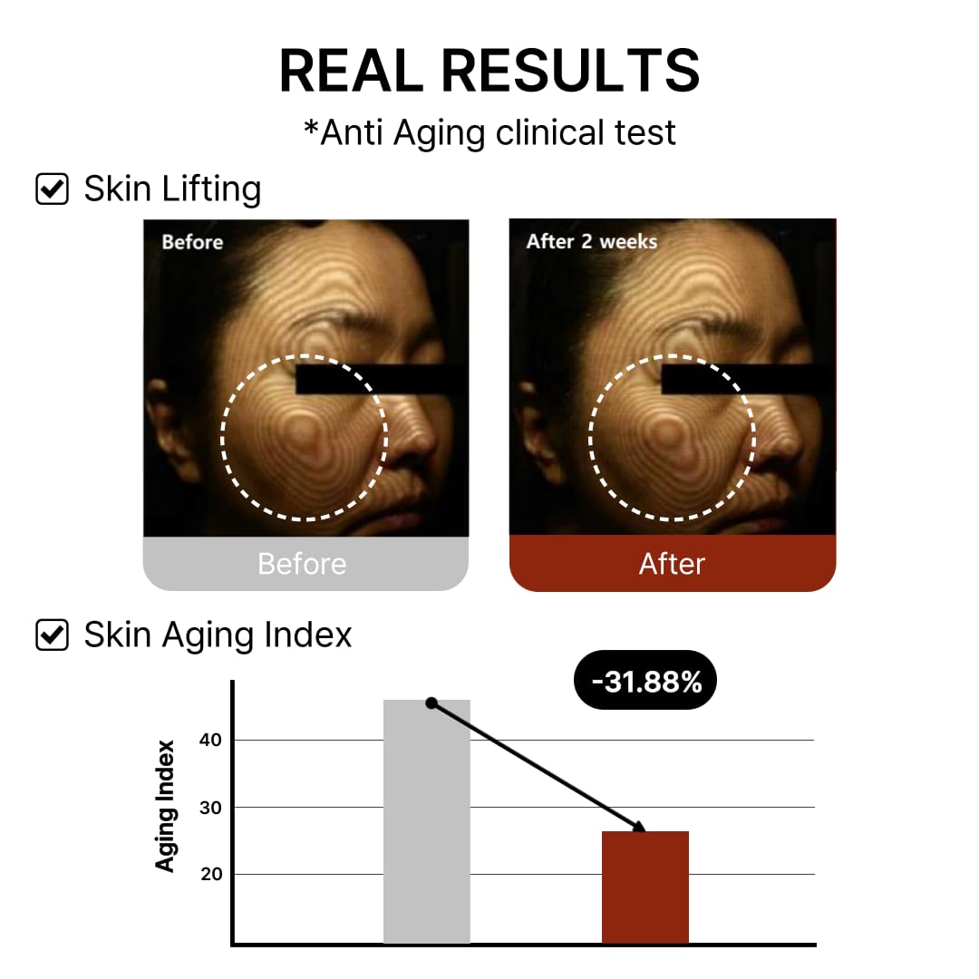 Mito-on Cell Rejuvenation Anti-Aging Serum, 30ml / 1.01 fl.oz –10% Niacinamide, Vitamin B3 and