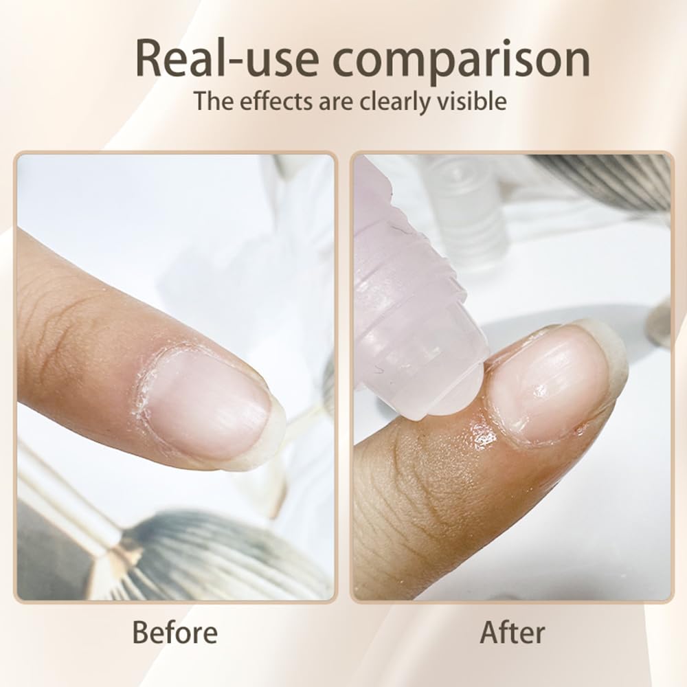 5pcs Cuticle Oil Roller Nourishing Moisturizing Roll On Cuticle Oil for Convenient Portable Nail