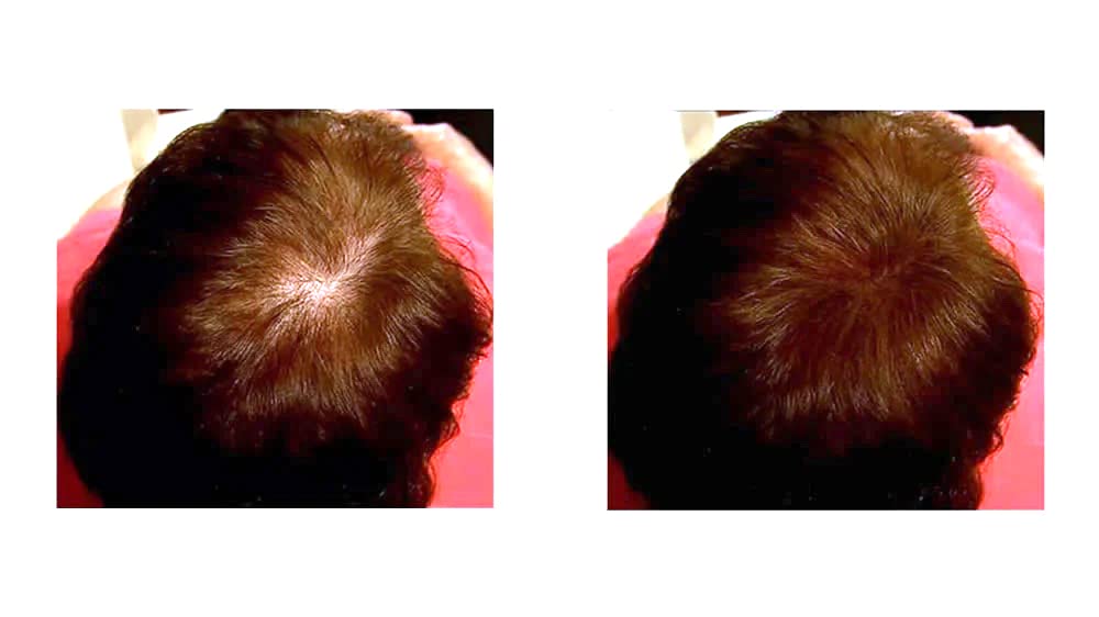 Caboki Hair Building Fiber. (30G, 90-Day Supply). Auburn