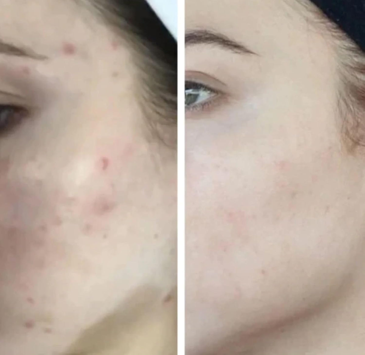 HigherDOSE Light-Activated GLOW SERUM - Anti Aging Face Serum to Plump, Hydrate & Smooth Fine Lines