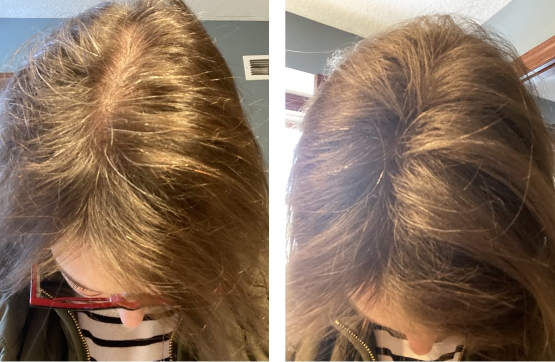 Caboki Hair Loss Concealer. All-Natural Hair Building Fiber. Make Thin Hair Look 10X Fuller