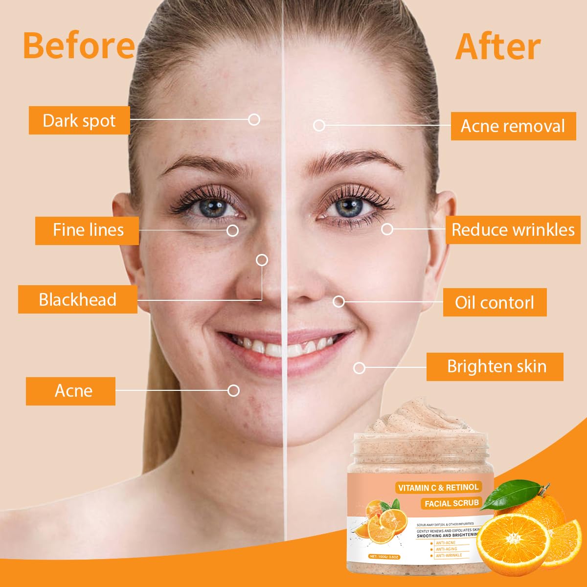 Vitamin C Face Scrub, Exfoliating Facial Wash with Retinol, Facial Scrub,Facial Exfoliating Scrub