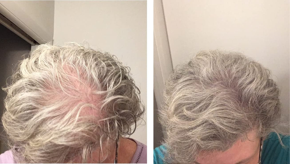 Caboki Hair Loss Concealer. All-Natural Hair Building Fiber. Make Thin Hair Look 10X Fuller