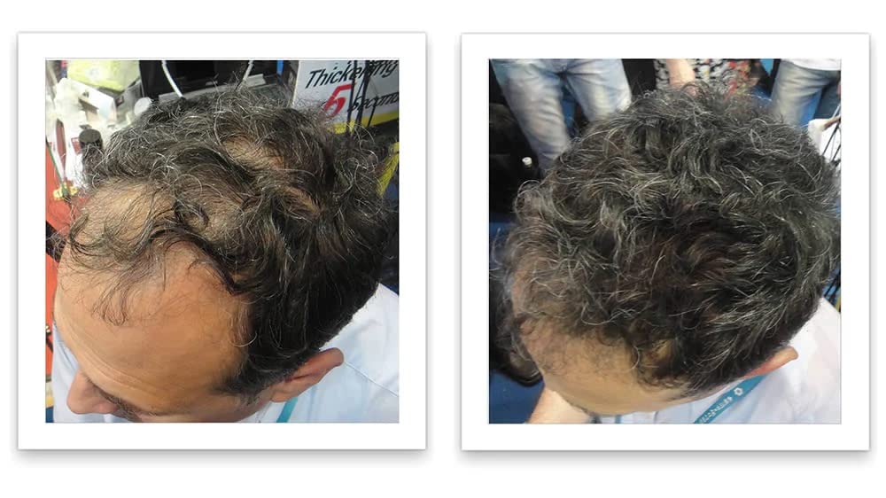 Caboki Hair Loss Concealer. All-Natural Hair Building Fiber. Make Thin Hair Look 10X Fuller