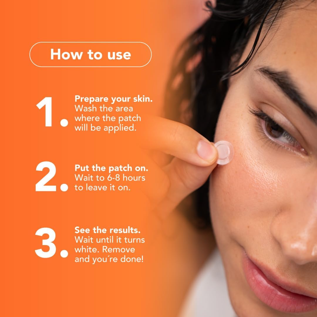ALUX Skin Pimple Patches for Face, 180 Unit, Hydrocolloid Skin Care Acne, Safe for Sensitive Skin