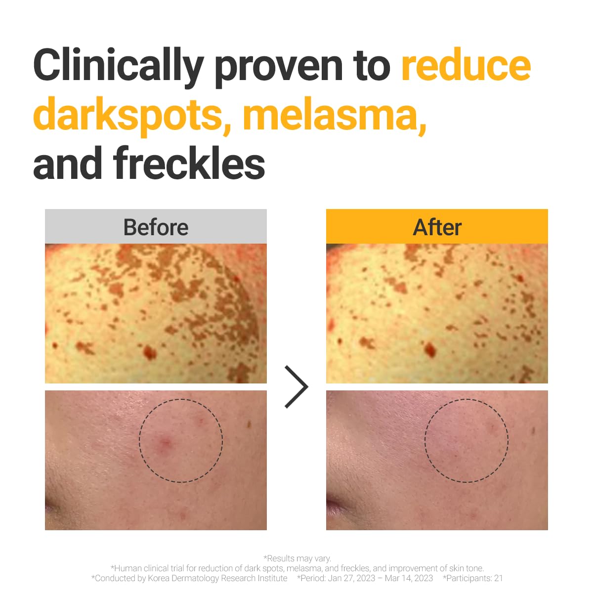 ROVECTIN Vita Dark Spot Serum for Clearing Blemish and Evening Skin Tone | Rich Vitamin C