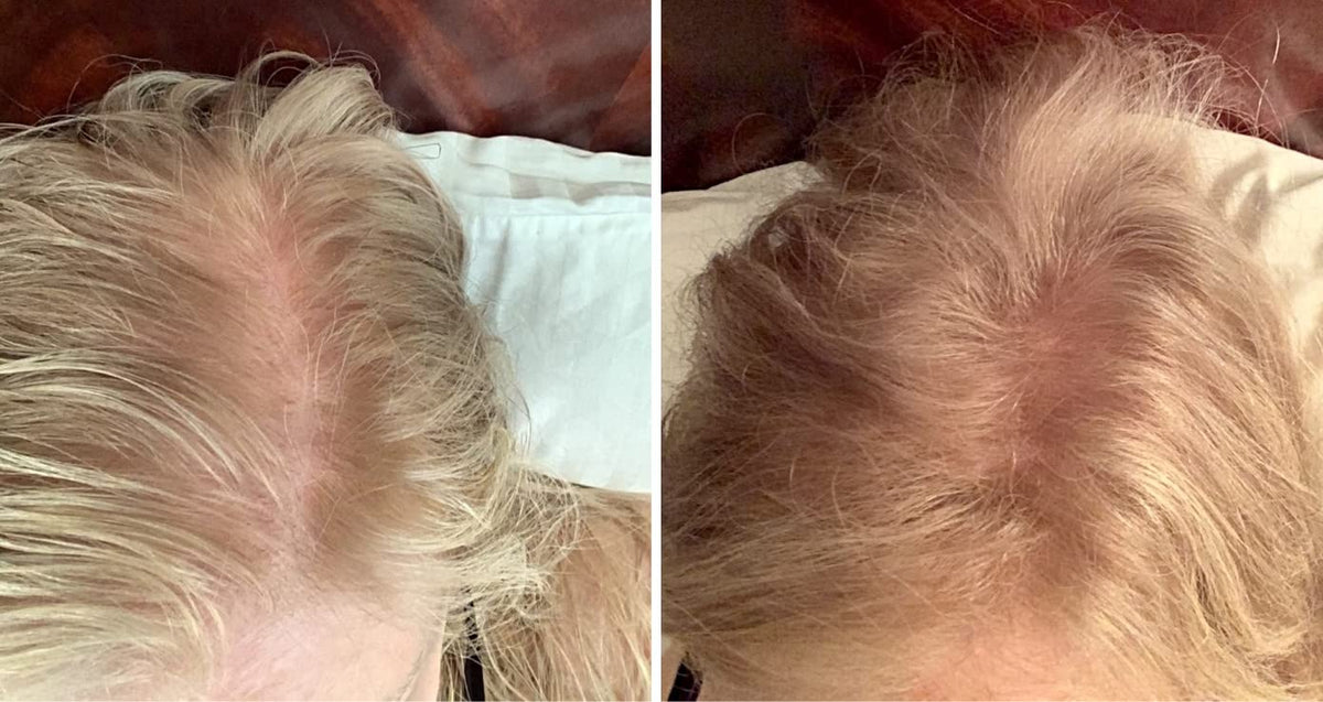 Caboki Hair Loss Concealer. All-Natural Hair Building Fiber. Make Thin Hair Look 10X Fuller