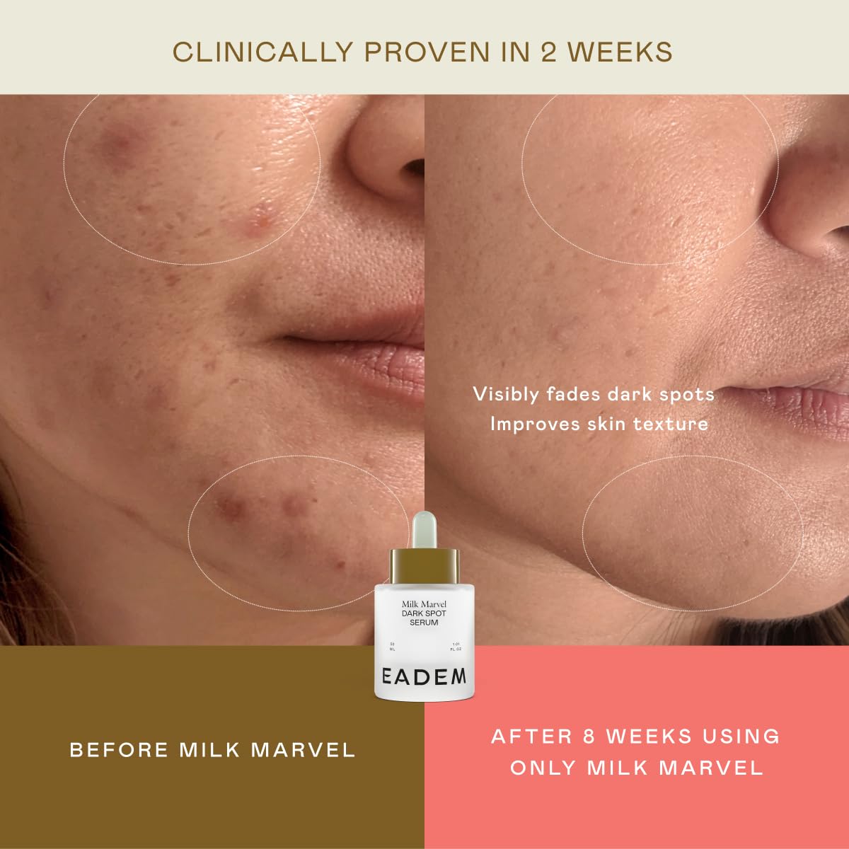 EADEM Milk Marvel Dark Spot Serum, Vitamin C Face Serum Infused with Niacinamide, Dark Spot Remover