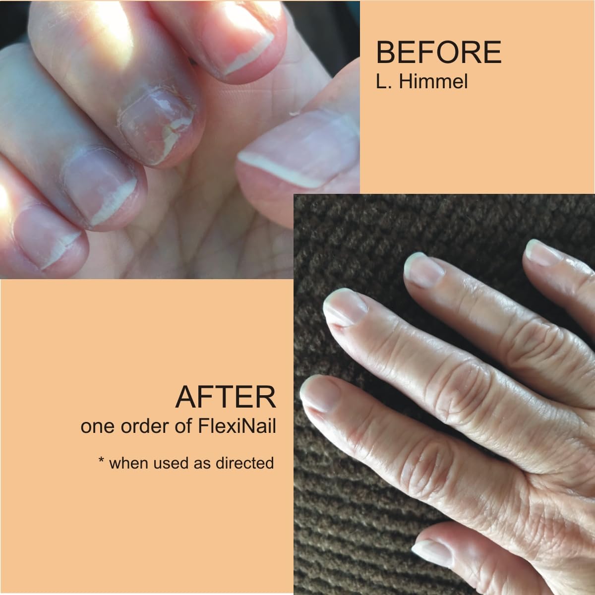 Penetrating Fingernail Conditioner and Strengthener to repair and then maintain weak and peeling or