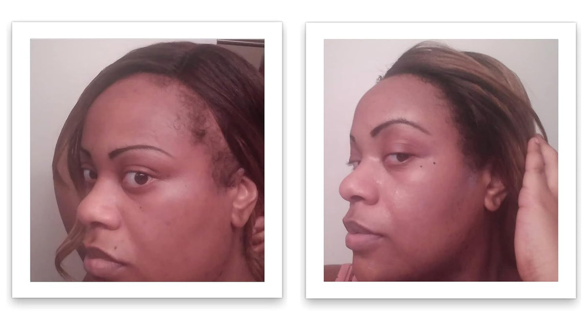 Caboki Hair Loss Concealer, All-Natural Hair Building Fiber. Make Thin Hair Look 10X Fuller