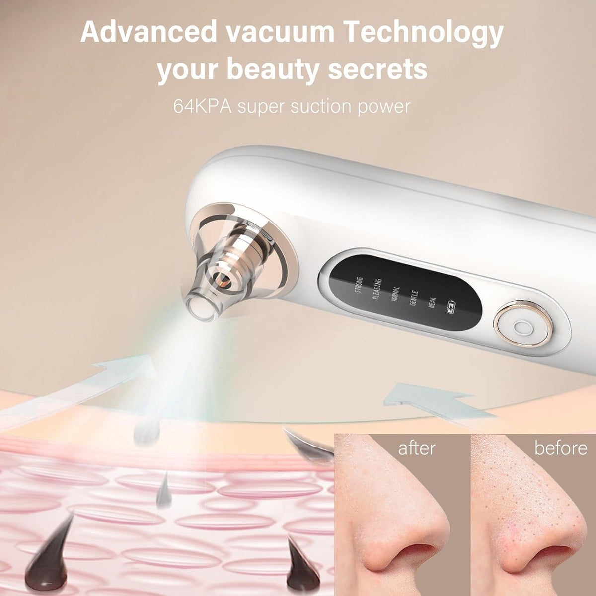 Blackhead Remover Pore Vacuum Kit for Face, 5 Adjustable Suction Levels Blackhead Extraction Tool
