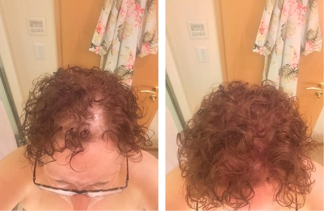 Caboki Hair Loss Concealer. All-Natural, Plant-Based Hair Building Fiber. Covers Bald Spot and