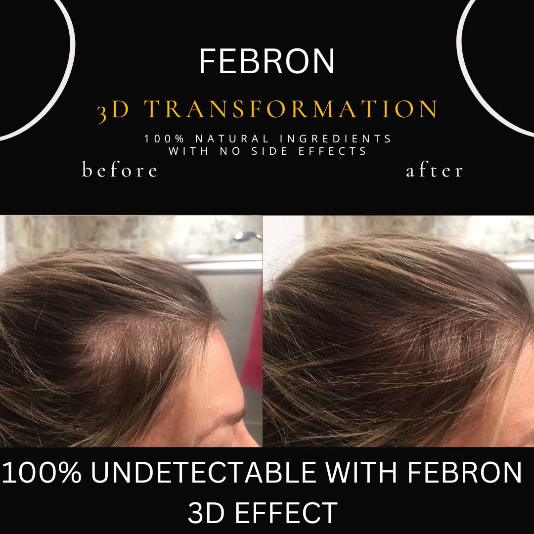 FEBRON Hair Fibers For Thinning Hair MEDIUM BROWN Giant 30G For Women & Men Hair Loss Concealer