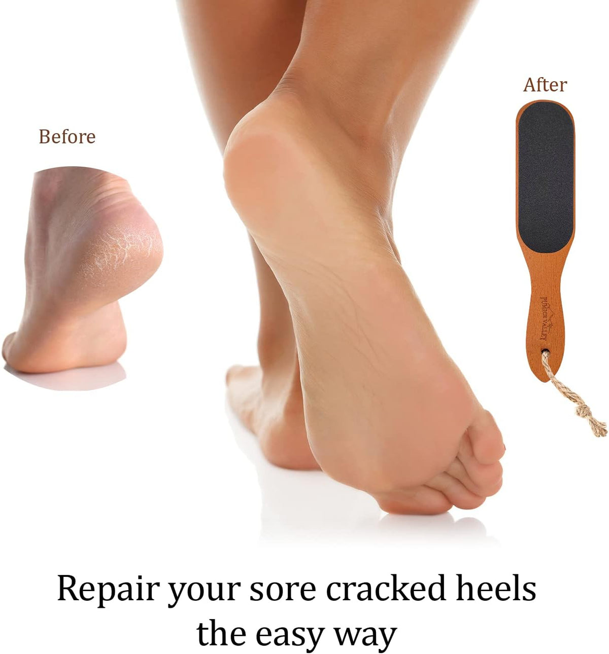Pumice Stone Foot File - Wooden Pedicure Feet Scrubber with Handle for Callus, Dry, and Dead Skin