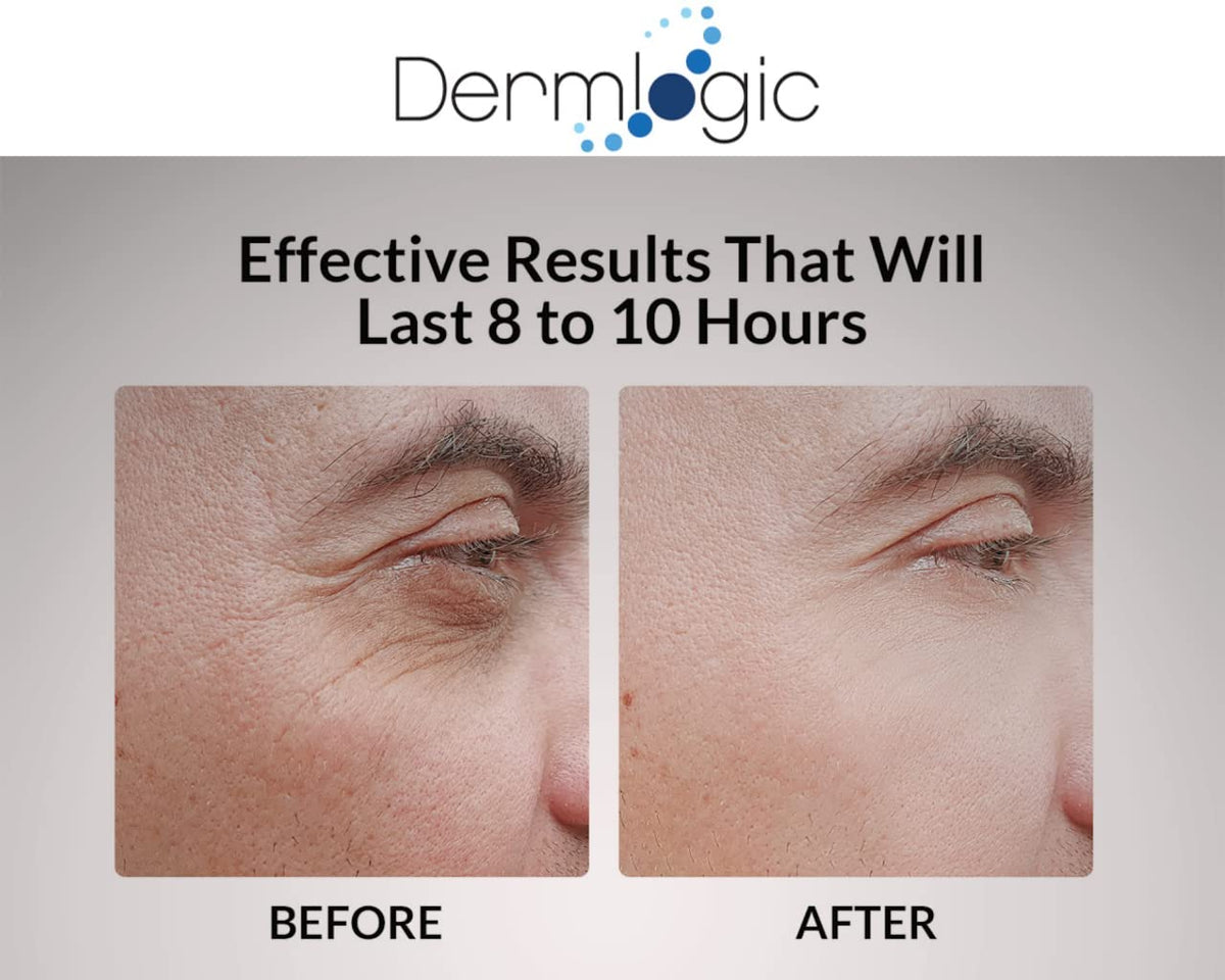 Under Eye Puffiness & Dark Circles Rapid Treatment- Instantly Reduces the Appearance of Puffy Eye