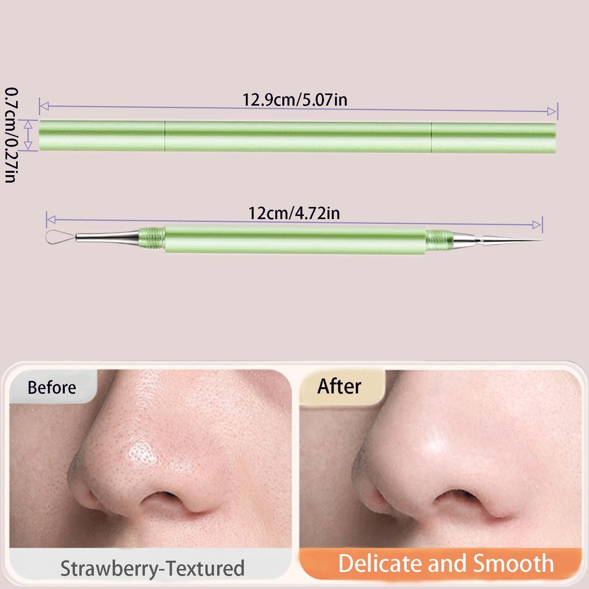2-in-1 Professional Stainless Steel Acne Removal Needle, Whitehead & Blackhead Remover Tool