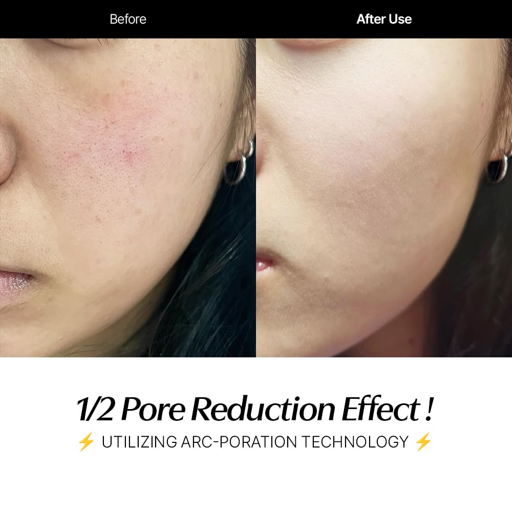 CELORABY Potension Penta-Shot Glass Skin Glow Booster | 5-in-1 Korean Skincare Device for Pore