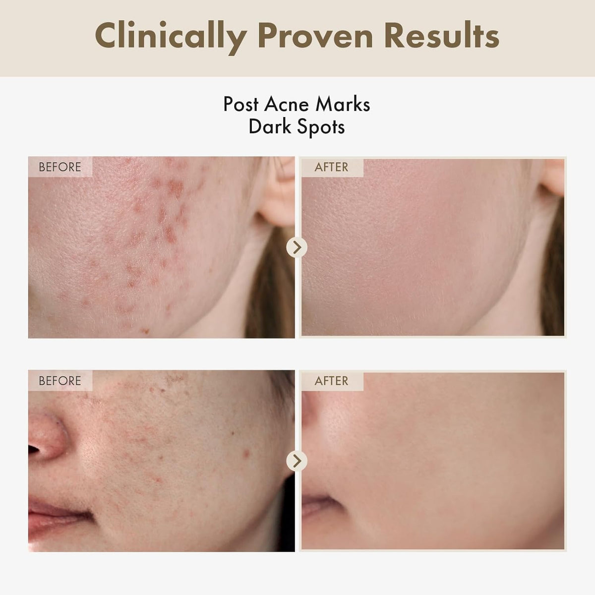 Alpha Arbutin 2% Rice Serum, Rice 746,074ppm, Alpha-Arbutin 20,000ppm, Glow, Glass skin