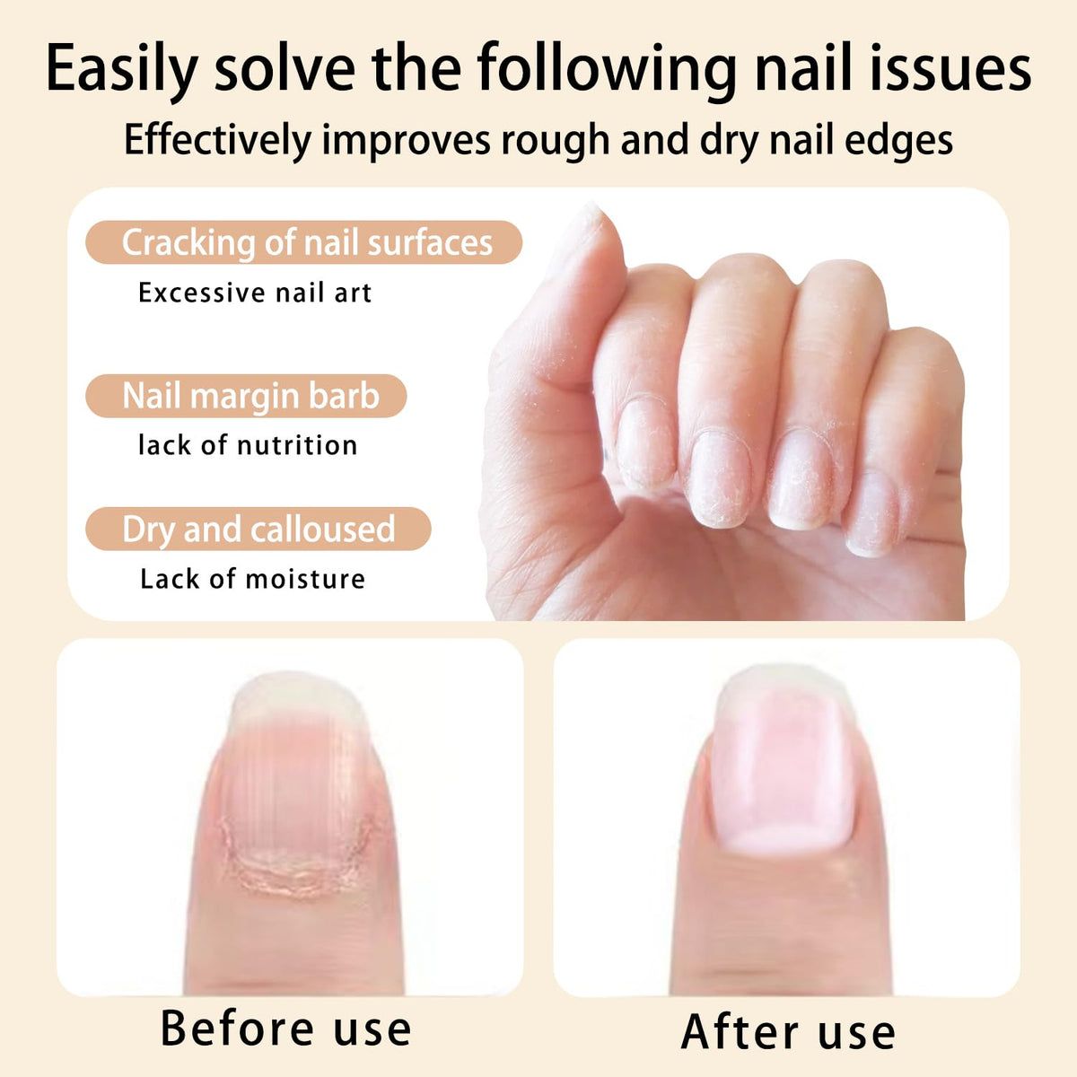 12pcs Cuticle Oil Pen Sweet Almond Nail Growth Serum and Repair Treatment Hydrating Oil for Dry