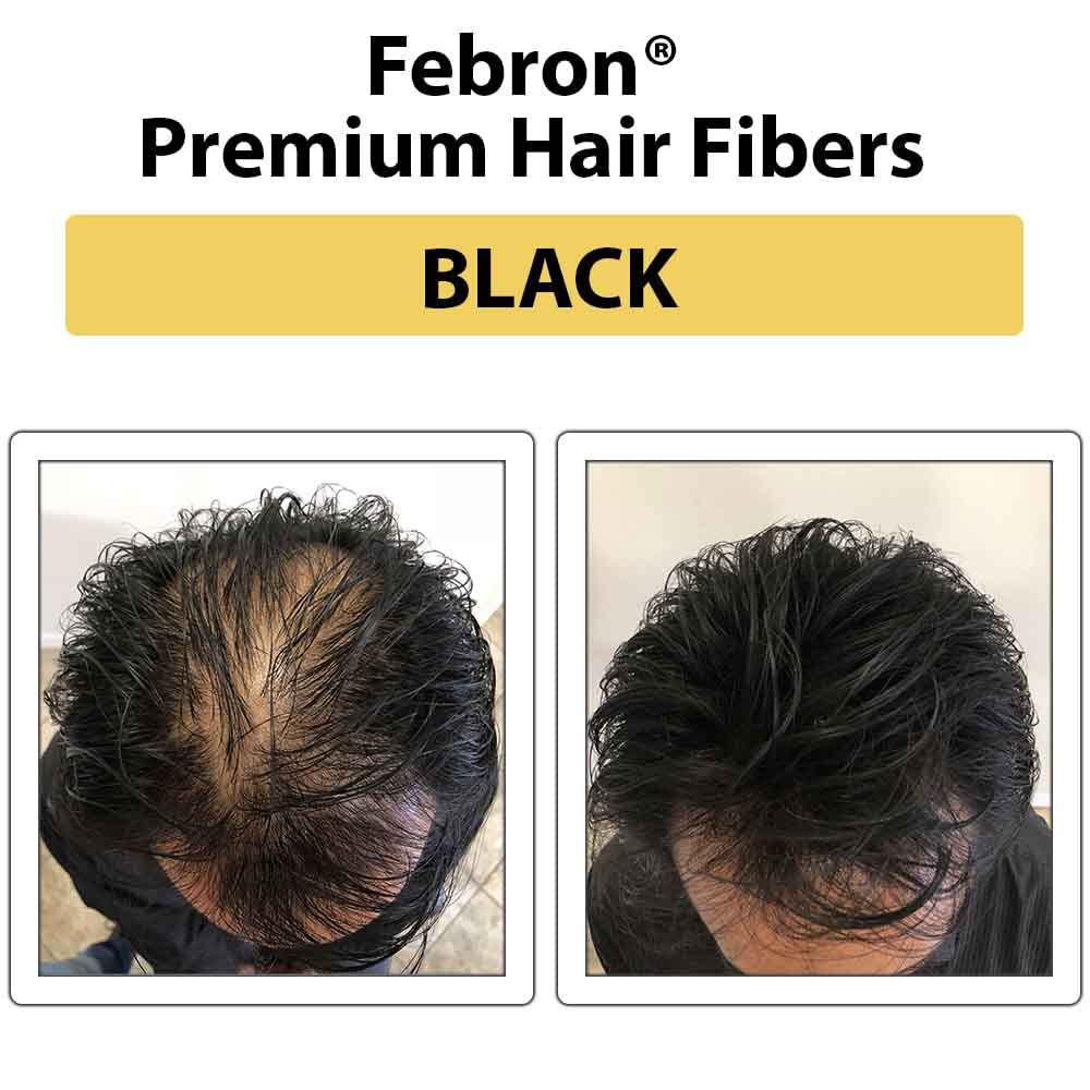 FEBRON Hair Fibers For Thinning Hair BLACK Giant 30G For Women & Men Hair Loss Concealer Hair