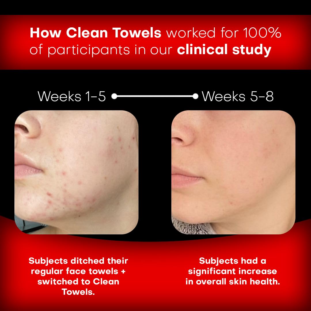 Face Towels | XL 8x8 Ultra Soft & Extra Thick Facial Wipes | Disposable Face Towelettes for