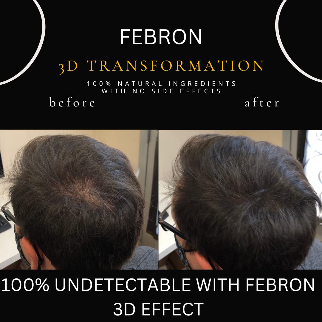 FEBRON Hair Fibers For Thinning Hair MEDIUM BROWN Giant 30G For Women & Men Hair Loss Concealer