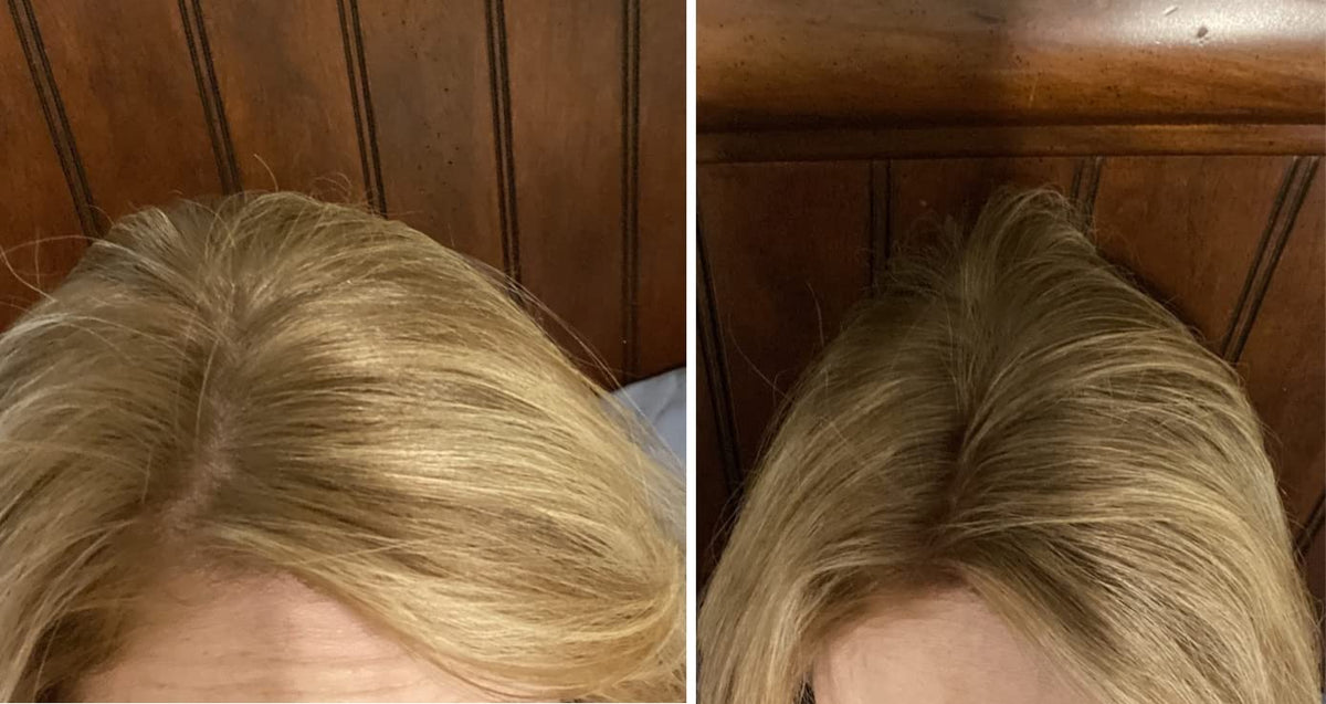 Caboki Hair Loss Concealer. All-Natural, Plant-Based Hair Building Fiber. Covers Bald Spot and