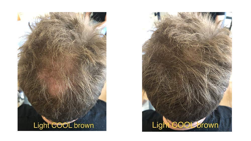 FEBRON Hair Fibers For Thinning Hair For Women & Men Hair Loss Concealer Hair Powder Volumizing