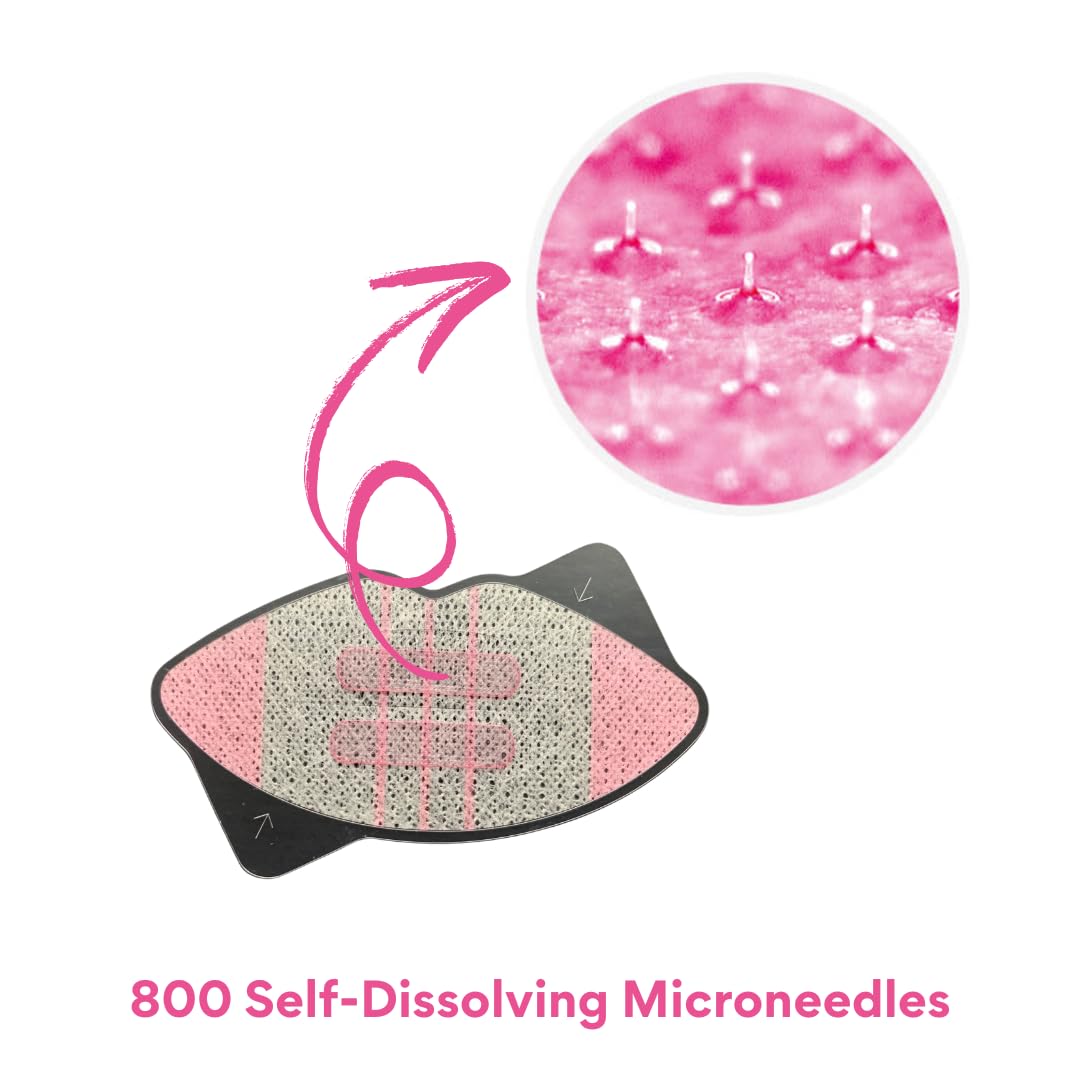 HyaluPlump Lips – Innovative Two-Step Lip Care System Featuring 800 Self-Dissolving Microneedles