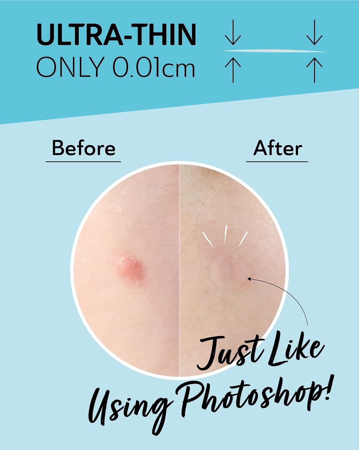 Invisible Salicylic Acid Pimple Patches for Face - Redness Reducing Hydrocolloid Acne Patches