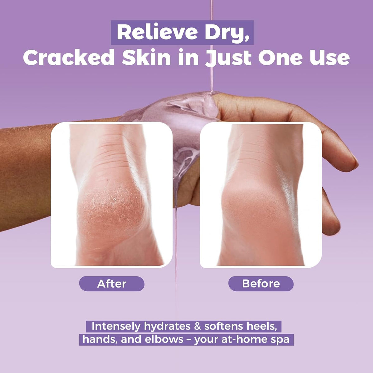 Paraffin Wax Refills 10 Packs for Paraffin Wax Bath Machine - for Dry Cracked Skin on Hands, Feet
