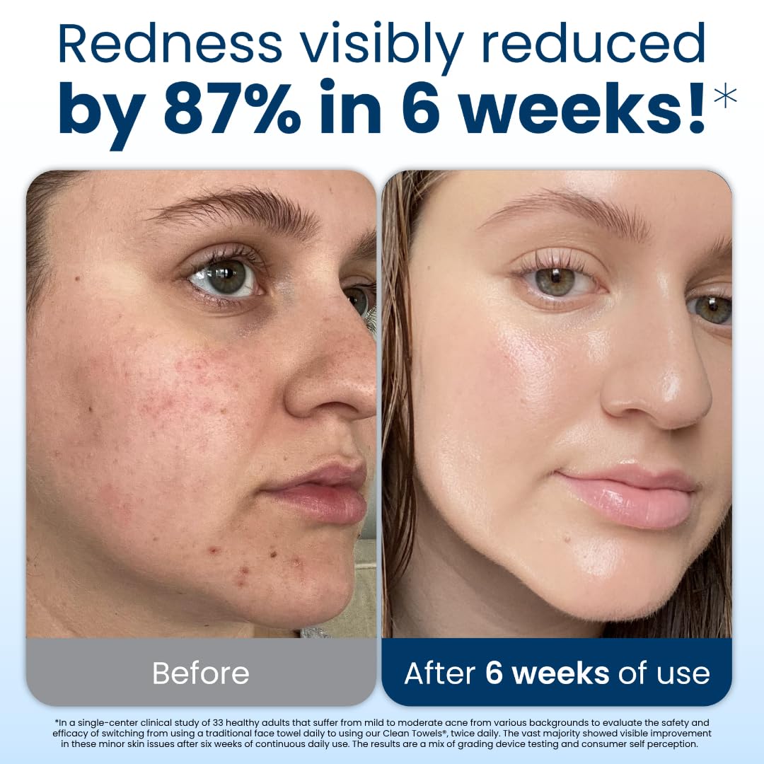 Clean Skin Club Clean Towels XL®, 100% USDA Biobased Face Towel, Disposable Face Towelette, Eczema