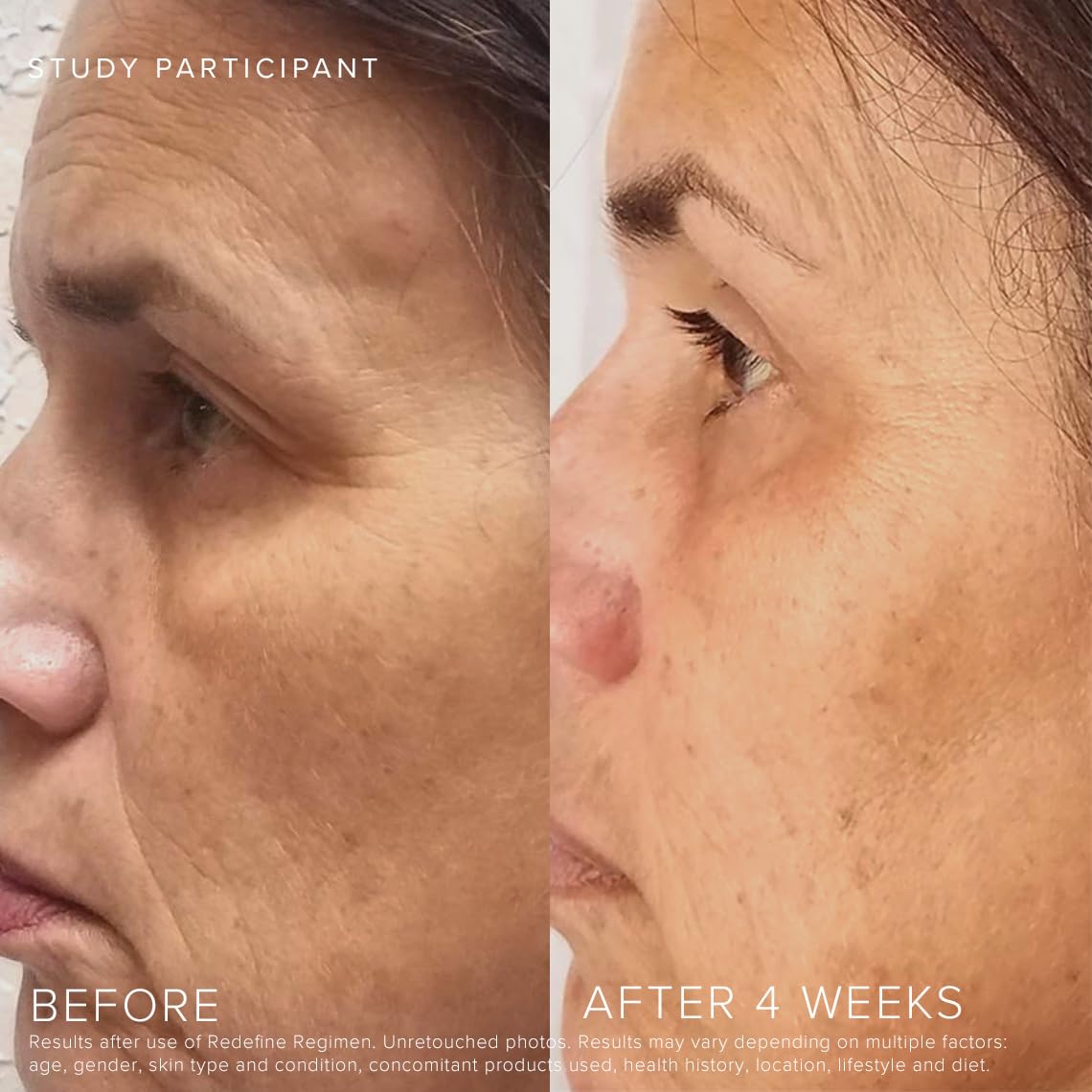RODAN + FIELDS Redefine Daily Foaming Cleanser | 125 mL | Gently Exfoliating Skin Care | Face Wash